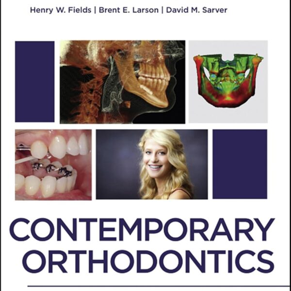 Contemporary Orthodontics