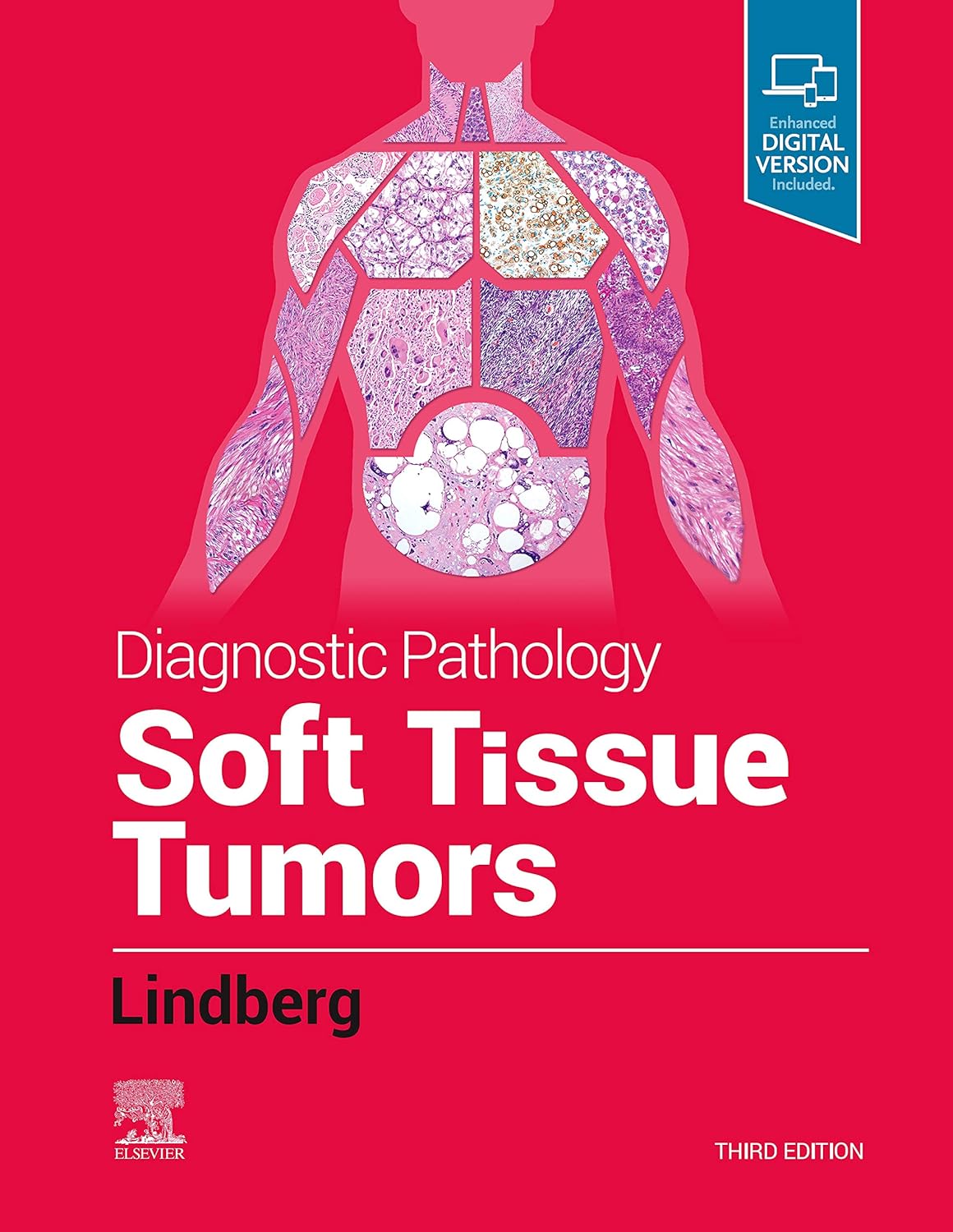 diagnostic-pathology-soft-tissue-tumors