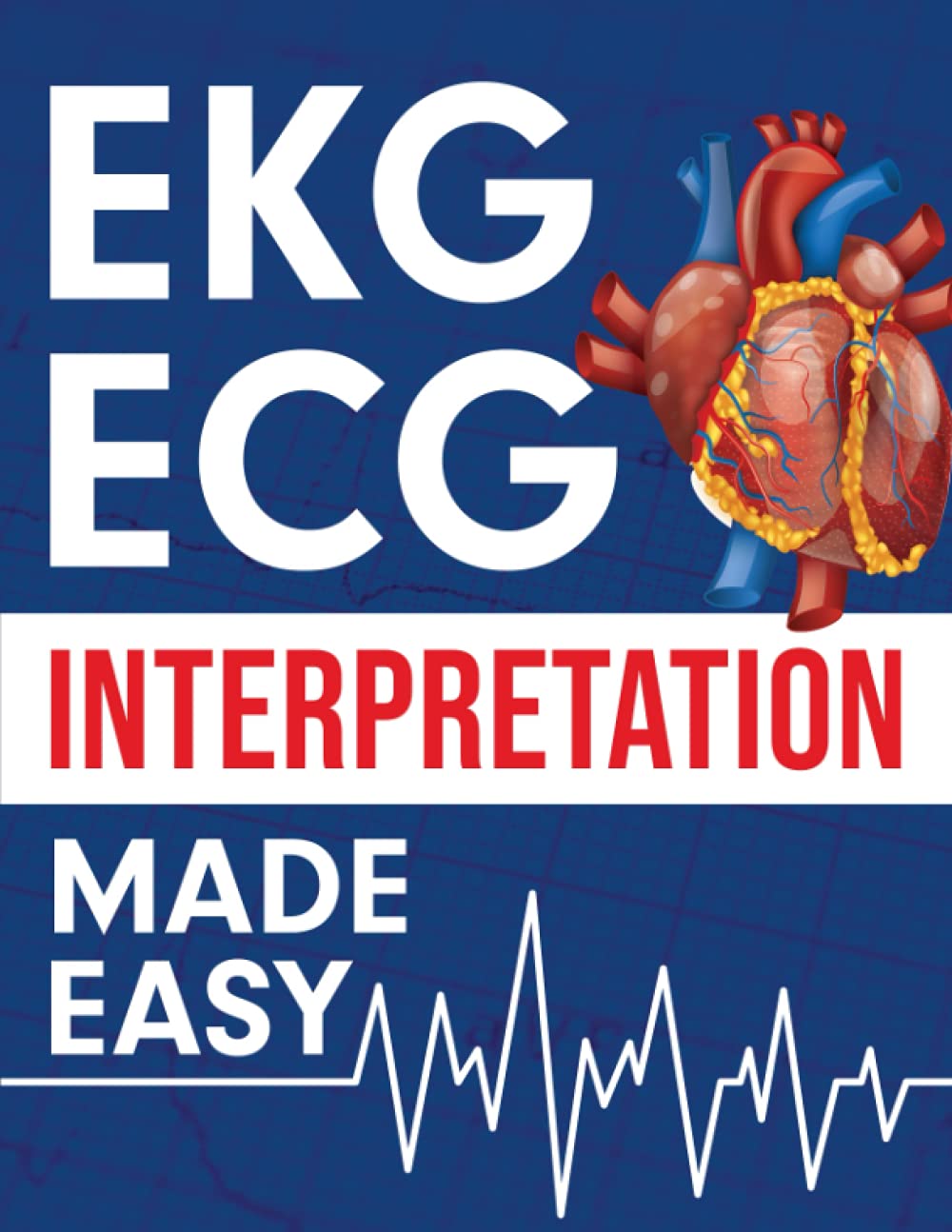 ekg-ecg-interpretation-made-easy-an-illustrated-study-guide-for-students-to-easily-learn-how-to-read-interpret-ecg-strips