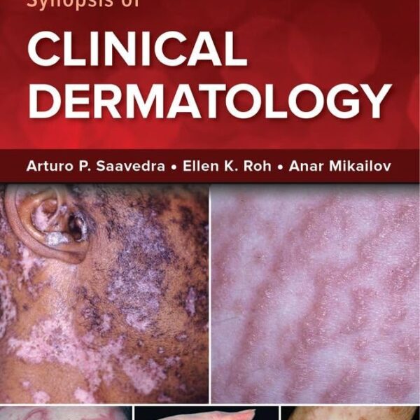 Fitzpatrick's Color Atlas and Synopsis of Clinical Dermatology, Ninth Edition