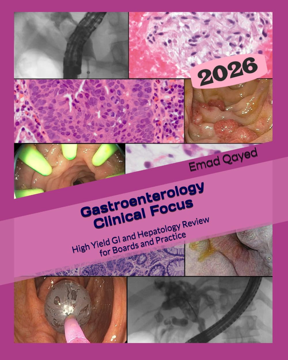 gastroenterology-clinical-focus-high-yield-gi-and-hepatology-review-for-boards-and-practice-3rd-edition