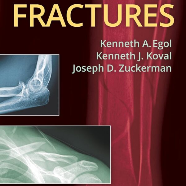 Handbook of Fractures