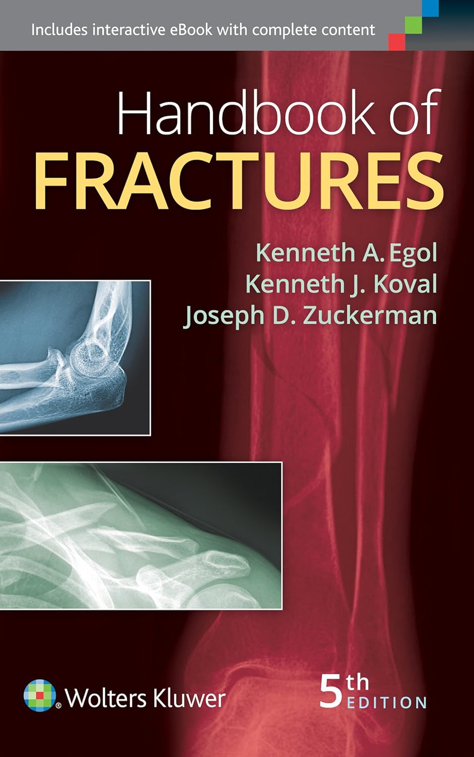 handbook-of-fractures