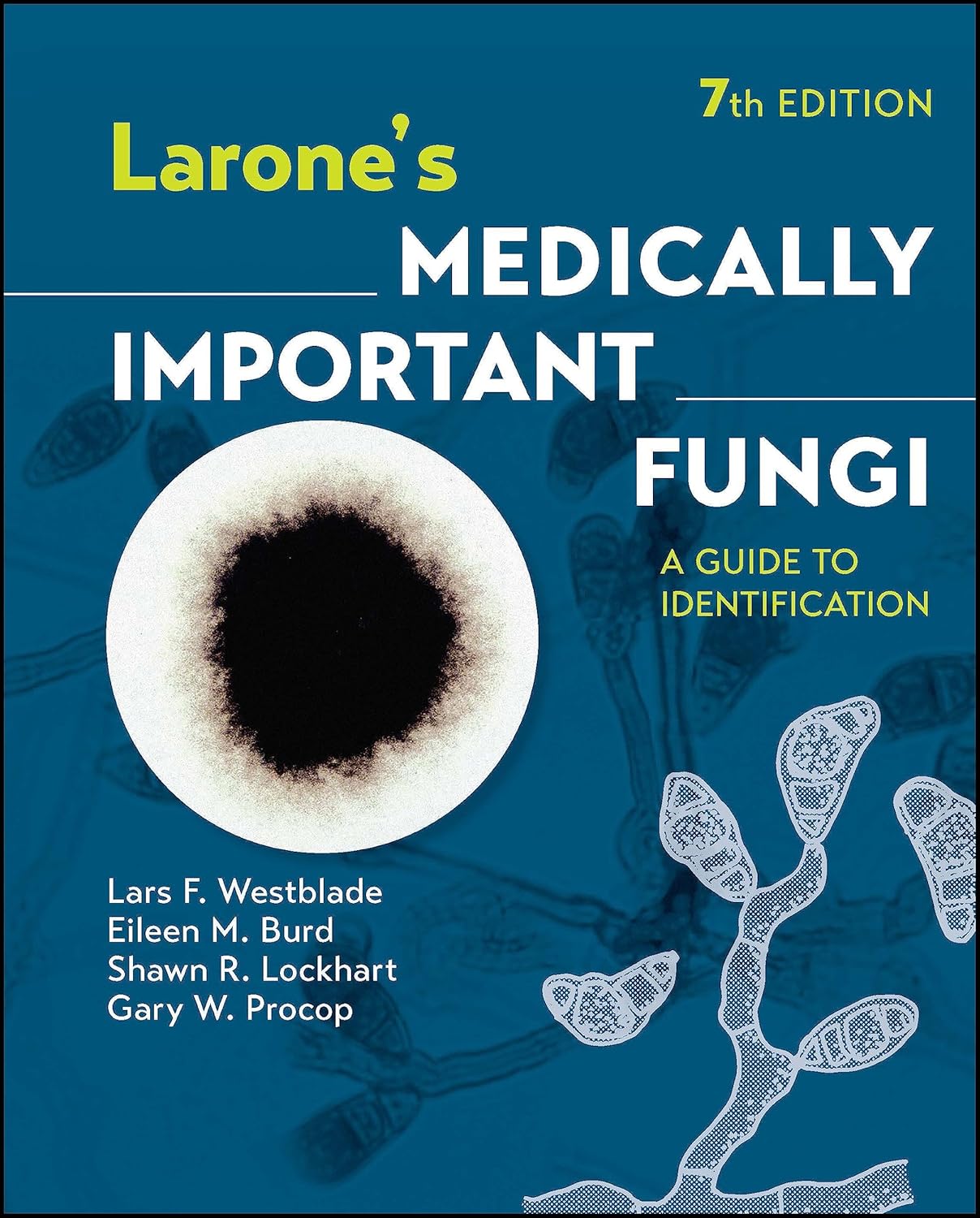 larone-s-medically-important-fungi-a-guide-to-identification