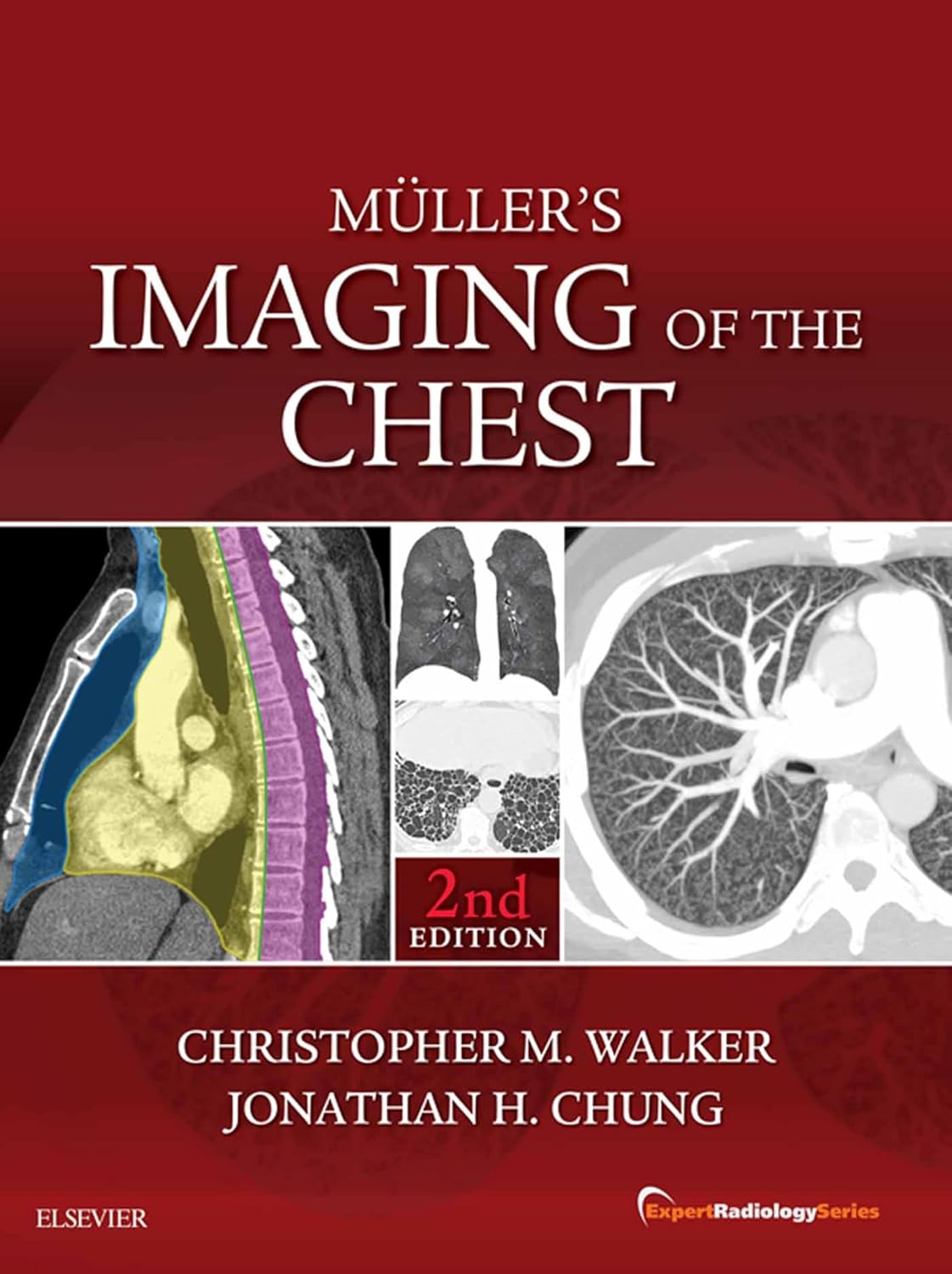mullers-imaging-of-the-chest-expert-radiology-series