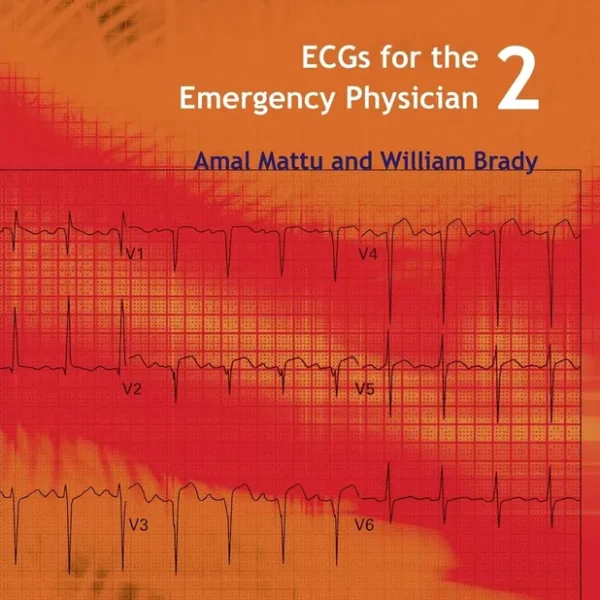ECGs for the Emergency Physician 2